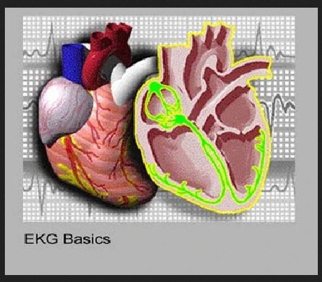 EKG BASICS IMAGE